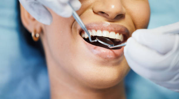 Best Emergency Dental Extractions in Lower Lake, CA